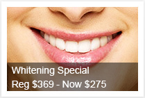 Teeth Whitening Special Offer